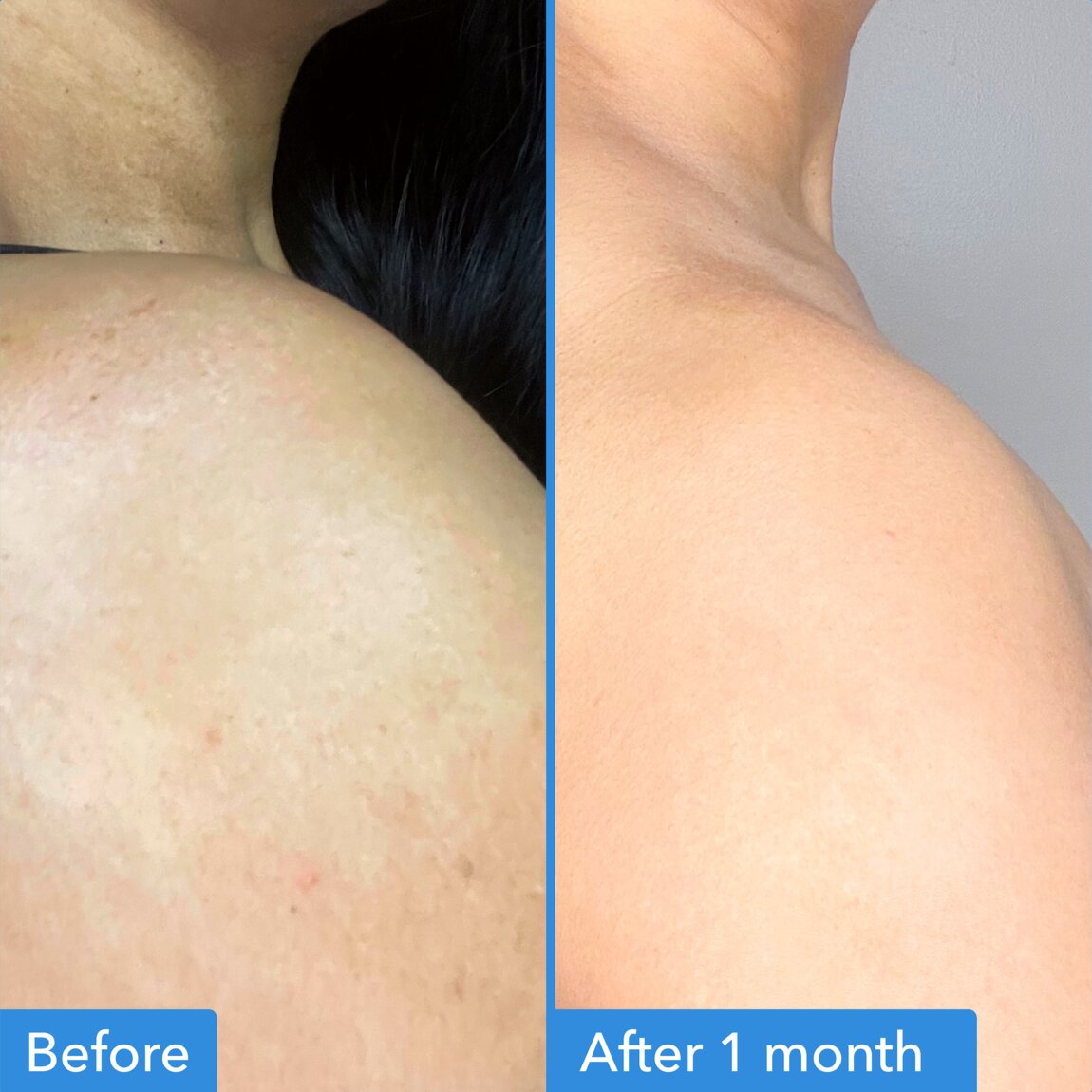 discoloration-correcting-body-treatment-t3 zb_p.jpg