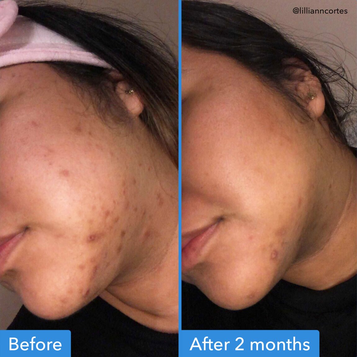 discoloration-correcting-serum-l0 zb_p.jpg