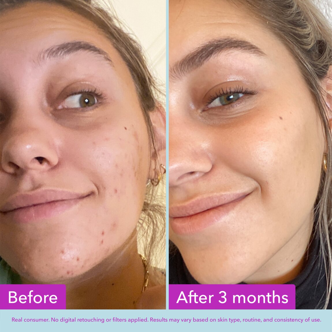 niacinamide-brightening-toner-z5 zb_p.jpg